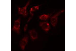 ABIN6274425 staining HepG2 cells by IF/ICC. (DCLK2 Antikörper  (N-Term))