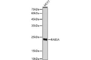 Western blot analysis of extracts of MCF7 cells, using RA antibody (ABIN3021646, ABIN3021647, ABIN3021648 and ABIN1513457) at 1:500 dilution. (RAB5 Antikörper  (AA 1-215))