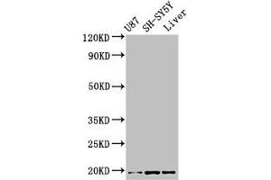 Western Blot Positive WB detected in: U87 whole cell lysate, SH-SY5Y whole cell lysate, Mouse liver tissue All lanes: TSLP antibody at 3. (Thymic Stromal Lymphopoietin Antikörper  (AA 29-159))