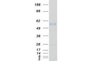 Western Blotting (WB) image for Pyruvate Dehydrogenase Complex, Component X (PDHX) (Transcript Variant 1) protein (Myc-DYKDDDDK Tag) (ABIN2728549)