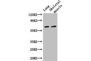 Western Blot Positive WB detected in: Mouse lung tissue, Mouse skeletal muscle tissue All lanes: PAK3 antibody at 3 μg/mL Secondary Goat polyclonal to rabbit IgG at 1/50000 dilution Predicted band size: 63, 61, 65 kDa Observed band size: 63 kDa (PAK3 Antikörper  (AA 70-190))