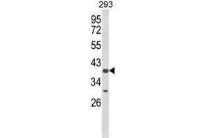 Western blot analysis of CSGALNACT2 Antibody (Center) in 293 cell line lysates (35ug/lane). (CSGALNACT2 Antikörper  (Middle Region))