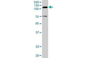 AXL MaxPab rabbit polyclonal antibody. (AXL Antikörper  (AA 1-894))