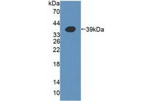 Detection of Recombinant a4GALT, Human using Polyclonal Antibody to Alpha-1,4-Galactosyltransferase (a4GALT) (A4GALT Antikörper  (AA 44-353))