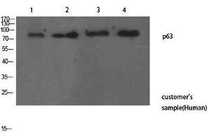 Western Blotting (WB) image for anti-T-Complex 1 (TCP1) (N-Term) antibody (ABIN3187722) (TCP1 alpha/CCTA Antikörper  (N-Term))