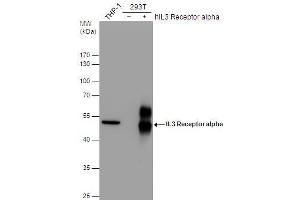 WB Image IL3 Receptor alpha antibody [N2C2], Internal detects IL3 Receptor alpha protein by western blot analysis. (IL3RA Antikörper)
