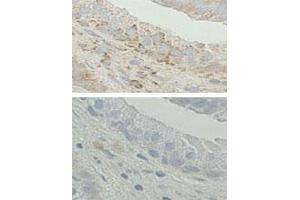 Immunohistochemistry on Formalin-fixed and paraffin-embedded human prostate tissue. (HSD17B10 Antikörper  (C-Term))