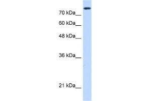 WB Suggested Anti-NCAPH Antibody Titration:  0. (NCAPH Antikörper  (C-Term))