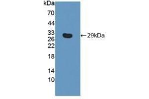Detection of Recombinant ITGb6, Human using Polyclonal Antibody to Integrin Beta 6 (ITGb6) (ITGB6 Antikörper  (AA 131-371))