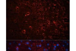 Immunofluorescence analysis of Mouse brain using Aquaporin 4 Polyclonal Antibody at dilution of 1:100 (40x lens). (Aquaporin 4 Antikörper)
