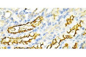Immunohistochemistry of paraffin-embedded Mouse kidney using PPP2R4 Polyclonal Antibody at dilution of 1:200 (40x lens). (PPP2R4 Antikörper)