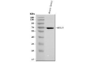 Western blot analysis of Mesothelin/Msln using anti-Mesothelin/Msln antibody (ABIN7601746).