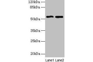 Western blot All lanes: STEAP3 antibody at 24 μg/mL Lane 1: HepG2 whole cell lysate Lane 2: Hela whole cell lysate Secondary Goat polyclonal to rabbit IgG at 1/10000 dilution Predicted band size: 55, 56, 51 kDa Observed band size: 55 kDa