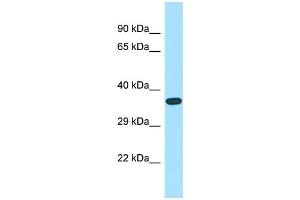 WB Suggested Anti-ASB14 Antibody Titration: 1. (ASB14 Antikörper  (N-Term))