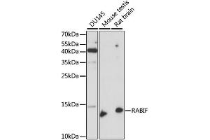 Western blot analysis of extracts of various cell lines, using RABIF antibody. (RABIF Antikörper)