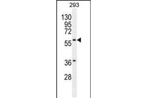Western blot analysis in 293 cell line lysates (35ug/lane). (Carboxypeptidase A2 Antikörper  (AA 179-208))