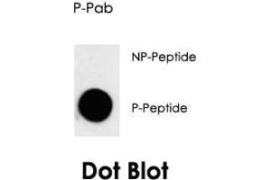 Dot blot analysis of CDK7 (phospho T170) polyclonal antibody  on nitrocellulose membrane. (CDK7 Antikörper  (pThr170))