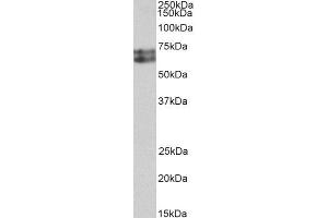 ABIN4902656 (0. (HDC Antikörper)