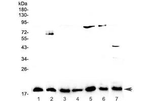 Western blot testing of 1) placenta, 2) PANC-1, 3) rat lymph, 4) rat small intestine, 5) rat testis, 6) rat ovary, and 7) mouse testis lysate with IL-23 antibody at 0. (IL23A Antikörper)