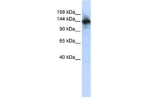 Western Blotting (WB) image for anti-RNA Binding Motif Protein 6 (RBM6) antibody (ABIN2457899) (RBM6 Antikörper)