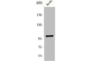 Western Blot analysis of HuvEc cells using NARG1 Polyclonal Antibody (NAA15 Antikörper  (Internal Region))