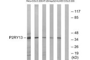 Western Blotting (WB) image for anti-Purinergic Receptor P2Y, G-Protein Coupled, 13 (P2RY13) (AA 209-258) antibody (ABIN2891070) (Purinergic Receptor P2Y, G-Protein Coupled, 13 (P2RY13) (AA 209-258) Antikörper)