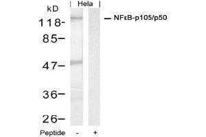 Image no. 1 for anti-Nuclear Factor of kappa Light Polypeptide Gene Enhancer in B-Cells 1 (NFKB1) (Ser927) antibody (ABIN319348) (NFKB1 Antikörper  (Ser927))