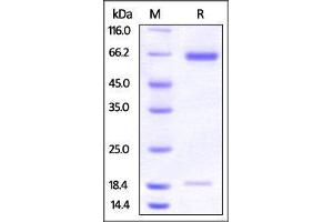 Hamster PCSK9, His Tag on SDS-PAGE under reducing (R) condition. (PCSK9 Protein (AA 30-691) (His tag))