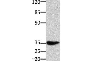 Western blot analysis of Mouse muscle tissue, using HOXA11 Polyclonal Antibody at dilution of 1:350 (Homeobox A11 Antikörper)