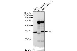 Immunoprecipitation analysis of 300 μg extracts of HepG2 cells using 3 μg  antibody (ABIN7265385). (ARPC2 Antikörper)