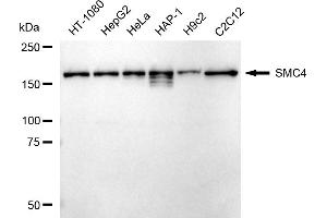 Western blotting analysis using SMC4 antibody (ABIN7800449). (Rekombinanter SMC4 Antikörper)