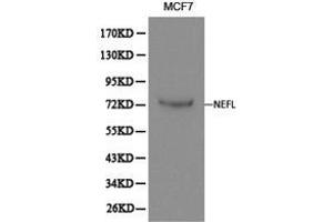 Western Blotting (WB) image for anti-Neurofilament, Light Polypeptide (NEFL) antibody (ABIN1873871) (NEFL Antikörper)