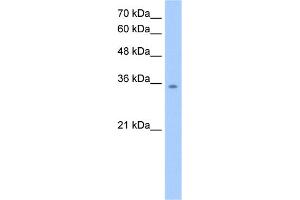 WB Suggested Anti-MDH2 Antibody Titration:  2. (MDH2 Antikörper  (C-Term))