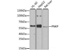 Western blot analysis of extracts of various cell lines using PNKP Polyclonal Antibody at dilution of 1:1000. (PNKP Antikörper)