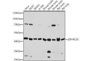Western blot analysis of extracts of various cell lines, using ZDHHC20 antibody (ABIN7271551) at 1:1000 dilution. (ZDHHC20 Antikörper)