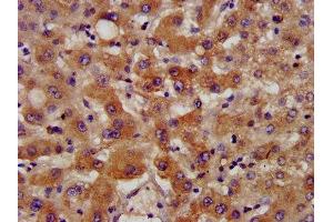 IHC image of ABIN7170786 diluted at 1:400 and staining in paraffin-embedded human liver tissue performed on a Leica BondTM system. (NSDHL Antikörper  (AA 154-211))