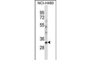 Western blot analysis in NCI-H460 cell line lysates (35ug/lane). (CEBPE Antikörper  (C-Term))