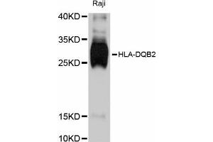 Western blot analysis of extracts of Raji cells, using HLA-DQB2 antibody (ABIN5997902) at 1:3000 dilution. (HLA-DQB2 Antikörper)