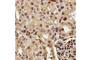 Immunohistochemical analysis of GGA2 staining in human kidney formalin fixed paraffin embedded tissue section.