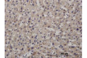 Immunoperoxidase of polyclonal antibody to NIPSNAP3A on formalin-fixed paraffin-embedded human liver. (NIPSNAP3A Antikörper  (Internal Region))