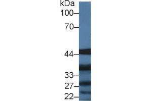 Western blot analysis of Pig Liver lysate, using Human IL13Ra1 Antibody (2 µg/ml) and HRP-conjugated Goat Anti-Rabbit antibody ( (IL13 Receptor alpha 1 Antikörper  (AA 203-376))