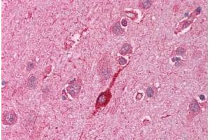 Human Brain, Cortex (formalin-fixed, paraffin-embedded) stained with HMOX2 antibody ABIN214113 at 5 ug/ml followed by biotinylated goat anti-rabbit IgG secondary antibody ABIN481713, alkaline phosphatase-streptavidin and chromogen. (HMOX2 Antikörper  (N-Term))