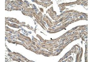 Asporin antibody was used for immunohistochemistry at a concentration of 4-8 ug/ml to stain Skeletal muscle cells (arrows) in Human Muscle. (Asporin Antikörper  (Middle Region))