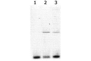 Lanes 1-3 contained Clock polyclonal antibody  immunoprecipitated DNA (15, 10 and 5 uL of antisera added respectively to the 900 uL of sonicated chromatin sample in the ChIP assay). (CLOCK Antikörper)