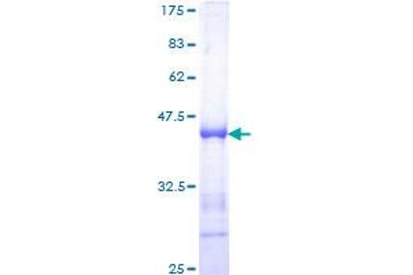 Splicing Factor 1 Protein (SF1) (AA 1-110) (GST tag)