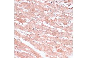 Immunohistochemistry of paraffin-embedded rat heart using RPL30 antibody (ABIN6130903, ABIN6147135, ABIN6147136 and ABIN6217777) at dilution of 1:100 (40x lens). (RPL30 Antikörper  (AA 1-115))