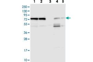 Western blot analysis of Lane 1: RT-4, Lane 2: U-251 MG, Lane 3: Human Plasma, Lane 4: Liver, Lane 5: Tonsil with KARS polyclonal antibody  at 1:250-1:500 dilution. (KARS Antikörper)