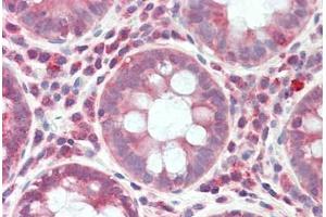 Immunohistochemistry (IHC) image for anti-Ribosomal Protein S6 Kinase, 52kDa, Polypeptide 1 (RPS6KC1) (AA 231-280) antibody (ABIN2879415)