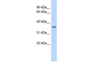 MMP23B antibody used at 1 ug/ml to detect target protein.