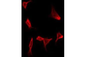ABIN6272275 staining HeLa by IF/ICC. (CMTM4 Antikörper  (N-Term))